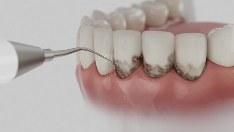 Reliable Dental Implants contractor in Bohemia, NY by Smile Center Dentistry